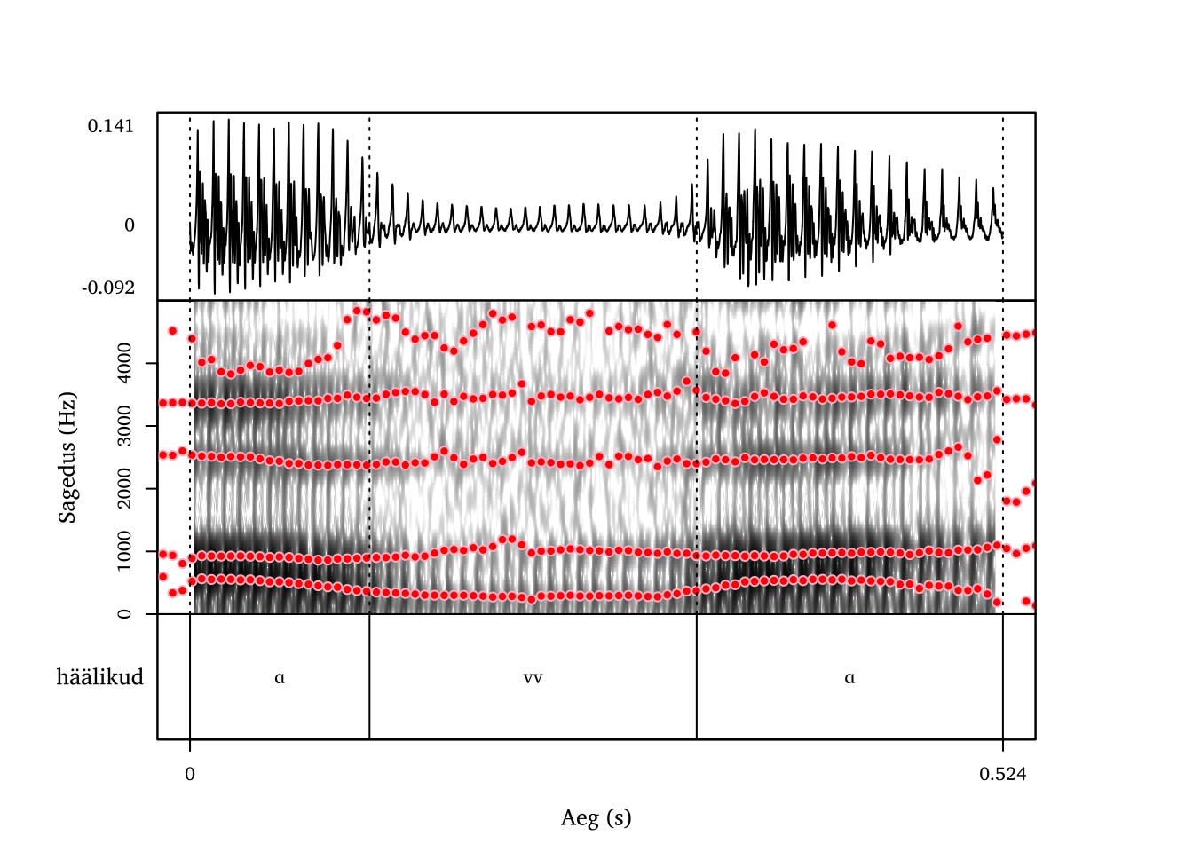 Heliline labiodentaalne frikatiiv /v/ (pseudo)sõnas avva.