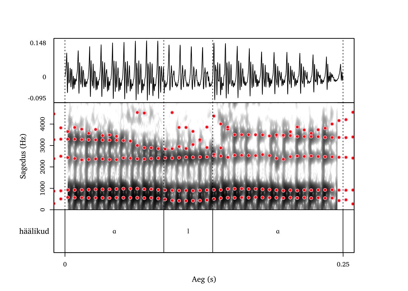 Alveolaarne lateraal /l/ sõnas ala.