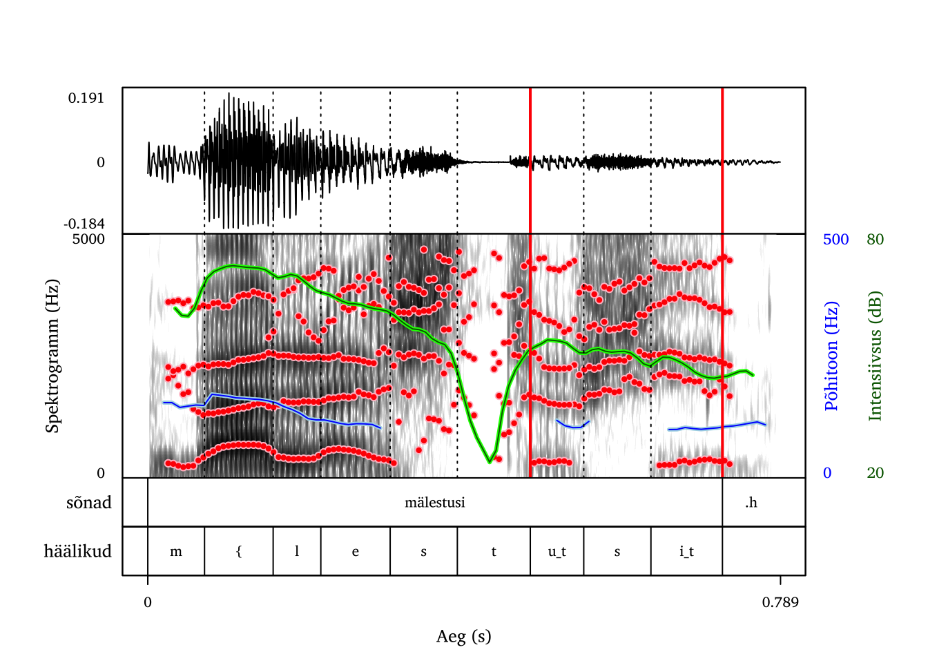 Kähisev hääl sõna lõpus (meeskõneleja).