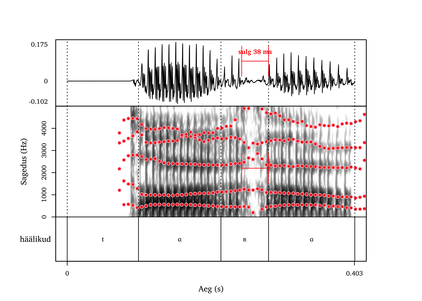 Uvulaarne tremulant [ʀ]: üheväringuline realisatsioon sõnas tara.